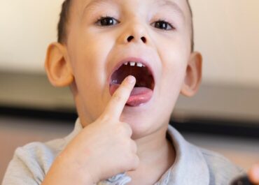 Menú infantil: porque todos tienen su favorito